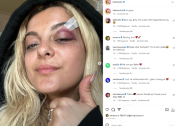 Bebe Rexha'ya konser sırasında telefon fırlatıldı