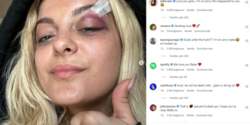 Bebe Rexha'ya konser sırasında telefon fırlatıldı