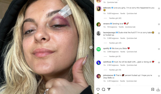 Bebe Rexha'ya konser sırasında telefon fırlatıldı