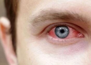 Uzmanından uyarı: Tatil öncesi göz sağlığınızı ertelemeyin