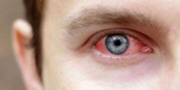 Uzmanından uyarı: Tatil öncesi göz sağlığınızı ertelemeyin