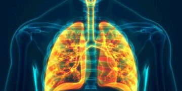 ‘Hava kirliliği de KOAH’a neden oluyor’