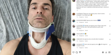 Oyuncu Özgür Özberk, yaya şeridine hızla girdiği için uyardığı şoför tarafından darbedildi