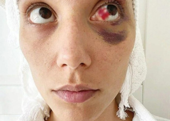 Şiddet davasında yeni gelişme! Ozan Güven cephesi kendi photoshop iddiasını boşa çıkardı: Araştırılmasın