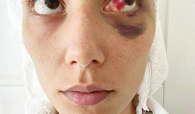 Şiddet davasında yeni gelişme! Ozan Güven cephesi kendi photoshop iddiasını boşa çıkardı: Araştırılmasın