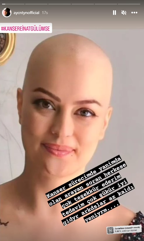Kanser tedavisi gören oyuncu Ayçin Tuyun, peruksuz fotoğrafını paylaştı
