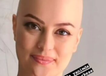 Kanser tedavisi gören oyuncu Ayçin Tuyun, peruksuz fotoğrafını paylaştı