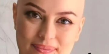 Kanser tedavisi gören oyuncu Ayçin Tuyun, peruksuz fotoğrafını paylaştı