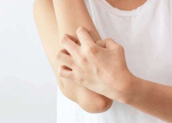 Strese bağlı cilt hastalıkları arttı