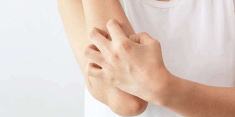 Strese bağlı cilt hastalıkları arttı