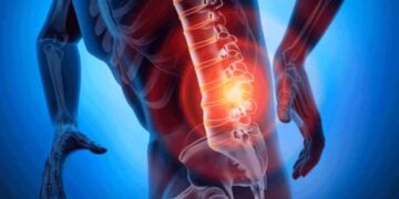 'Tedavi edilmeyen kasık fıtığı sindirimi vurabilir'