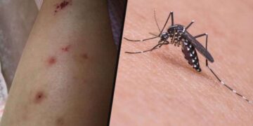 İzmir’de Asya Kaplan Sivrisineği paniği