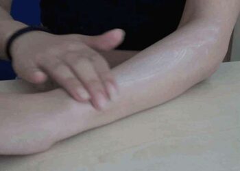 Uzmanı uyardı: Güneş yanıklarına evde tedavi uygulanmamalı