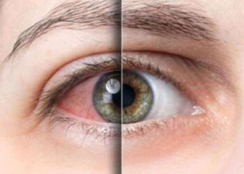 Klima gözlerinizi kurutuyorsa bunlara dikkat edin! Göz sağlığınızı korumak işte bu kadar kolay