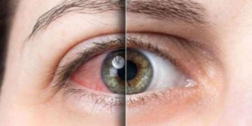 Klima gözlerinizi kurutuyorsa bunlara dikkat edin! Göz sağlığınızı korumak işte bu kadar kolay