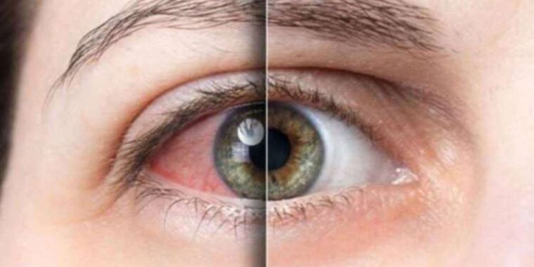 Klima gözlerinizi kurutuyorsa bunlara dikkat edin! Göz sağlığınızı korumak işte bu kadar kolay