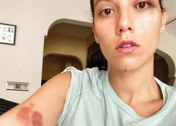 Deniz Bulutsuz ve Ozan Güven davasında adli tıp raporu mahkemeye ulaştı