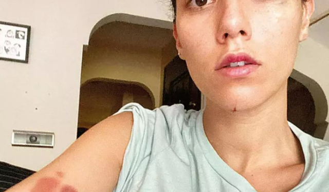 Deniz Bulutsuz ve Ozan Güven davasında adli tıp raporu mahkemeye ulaştı