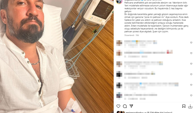 Doğukan Manço, patlıcan alerjisinden dolay hastanelik oldu