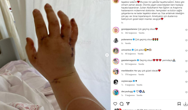 Eşi tarafından 32 yerinden bıçaklanan fenomen Merve Veziroğlu'ndan ilk paylaşım: Mucizevi şekilde hayatta kaldım