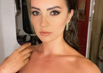 Herkes doğal güzel zannediyordu! Burcu Özberk'in estetiksiz halini görenler yıkıldı