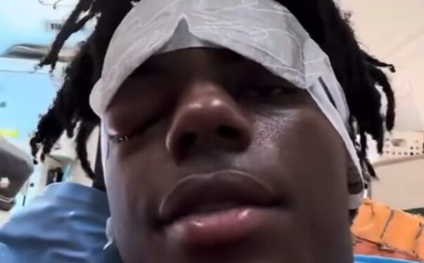 IShowSpeed'e ne oldu? Speed'in hastalığı cluster headache nedir?