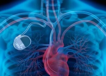 Kalıcı kalp pili olanların uyması gereken 8 kural