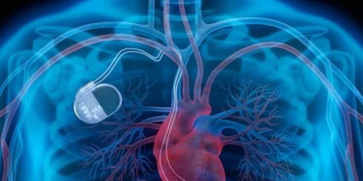 Kalıcı kalp pili olanların uyması gereken 8 kural