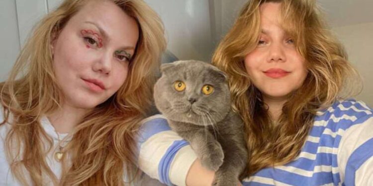 Evli olduğu erkek tarafından 32 yerinden bıçaklanmıştı: Fenomen Merve Veziroğlu Yıldırım’dan ilk paylaşım