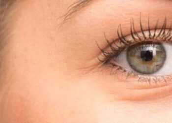 Kaz ayaklarınızdan kurtulmak bu kadar kolay! Evde yapabileceğiniz doğal karışımla etkili çözüm…