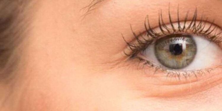 Kaz ayaklarınızdan kurtulmak bu kadar kolay! Evde yapabileceğiniz doğal karışımla etkili çözüm…