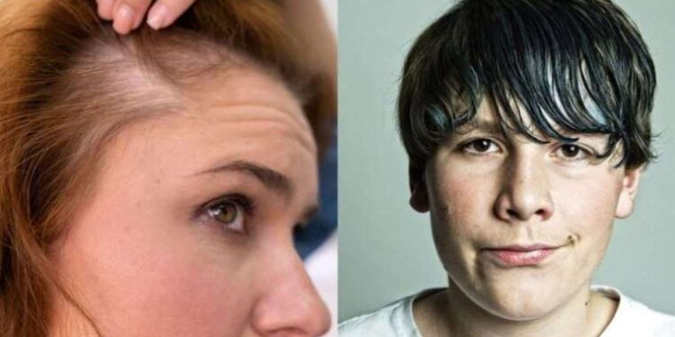 İbrahim Saraçoğlu saç yağlanmasını ve dökülmesini önleyen formülü açıkladı! 1 tatlı kaşığı ile hazırlanıyor…