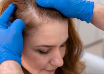 Saçlarınız kökünden fışkıracak! İşte Dr. Ender Saraç’ın o mucizevi karışımı..