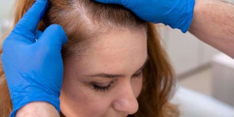 Saçlarınız kökünden fışkıracak! İşte Dr. Ender Saraç’ın o mucizevi karışımı..