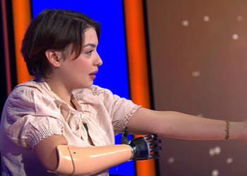 Kim Milyoner Olmak İster'in şampiyonu Rabia Birsen Göğercin, ampute edilen kolunun hikayesini anlattı: 1 yıl önce kıyma makinasına kaptırdım