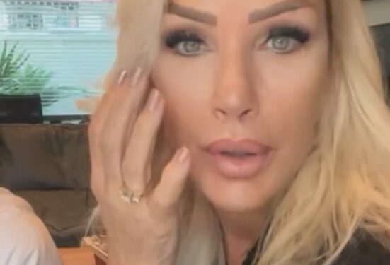 Seda Sayan genç görünmek için yüzüne sünnet derisinden elde edilen sıvıyı enjekte ettirdi