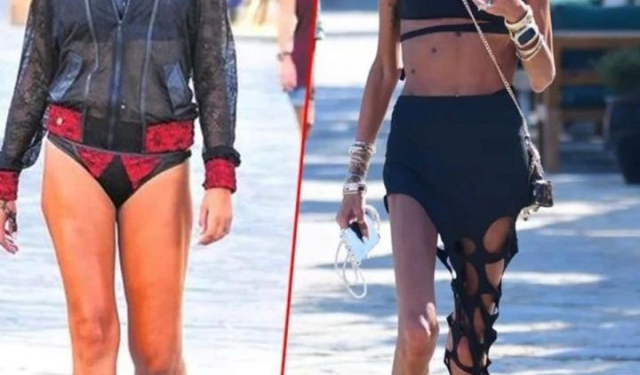 Süreyya Yalçın son görüntüsüyle sevenlerini korkuttu