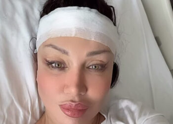 Umut Akyürek, Türkiye'de nadir yapılan alın daraltma operasyonu geçirdi