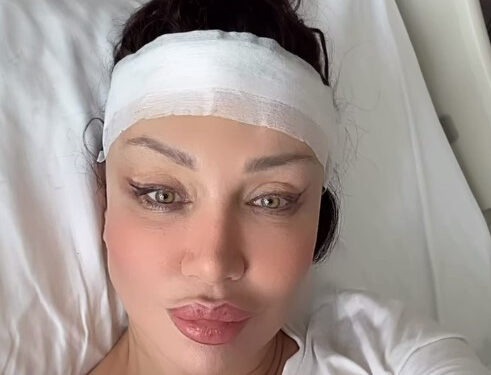 Umut Akyürek, Türkiye'de nadir yapılan alın daraltma operasyonu geçirdi