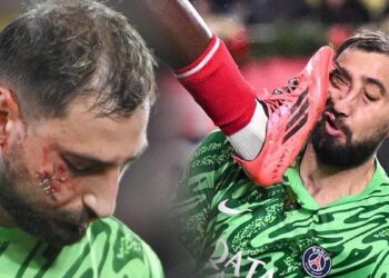 Monaco – PSG maçında skandal! Yürekleri ağza getiren faule kart bile çıkmadı!