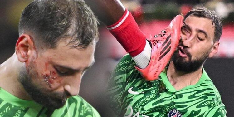 Monaco – PSG maçında skandal! Yürekleri ağza getiren faule kart bile çıkmadı!