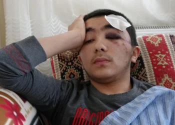 Isparta’da başıboş köpeklerden kaçan çocuk, büyük bir tehlike atlattı