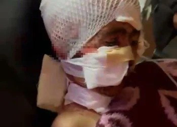 Erzurum'da köpek saldırısına uğrayan çocuğun babası ağladı