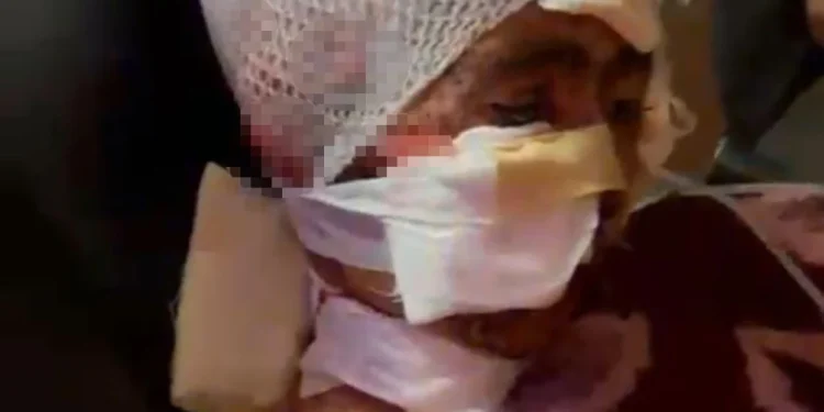 Erzurum'da köpek saldırısına uğrayan çocuğun babası ağladı