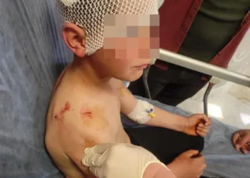 Isparta'da başıboş köpekler 9 yaşındaki çocuğa saldırdı