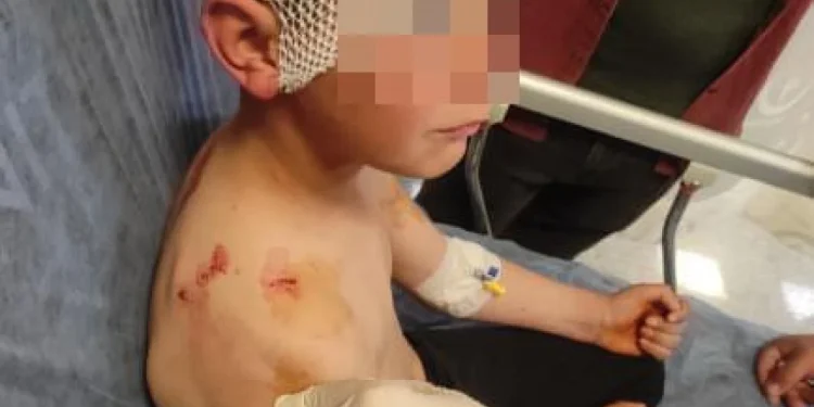 Isparta'da başıboş köpekler 9 yaşındaki çocuğa saldırdı