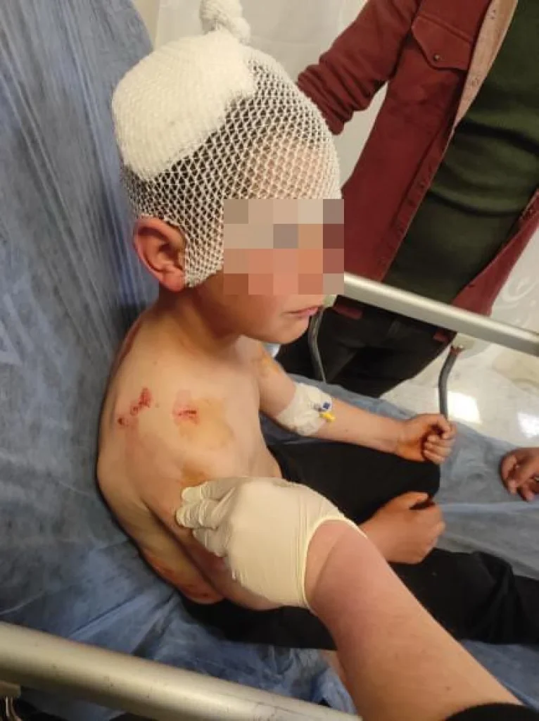 Isparta'da başıboş köpekler 9 yaşındaki çocuğa saldırdı