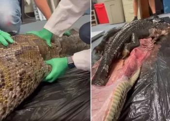 "Bilim Dünyası Şokta! Midesinden 1.5 Metrelik Timsah Çıkan İnsan İnanılmaz Olayı Konuşuyor"