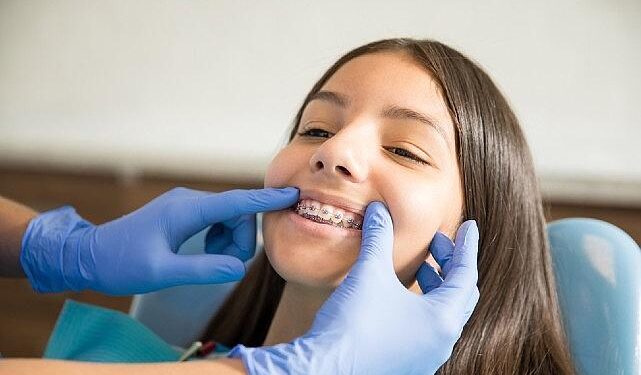 Ortodontik Tedaviler İçin ‘Ergenlik’ En İdeal Dönem