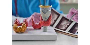 Yalancı Nodüller Gereksiz Tiroit Ameliyatlarına Yol Açabiliyor!